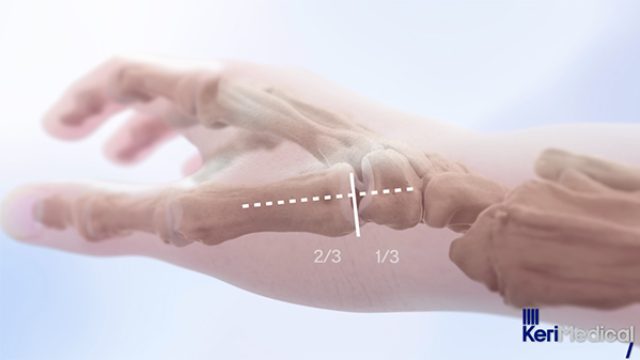 Film d'animation 3D — KeriMedical